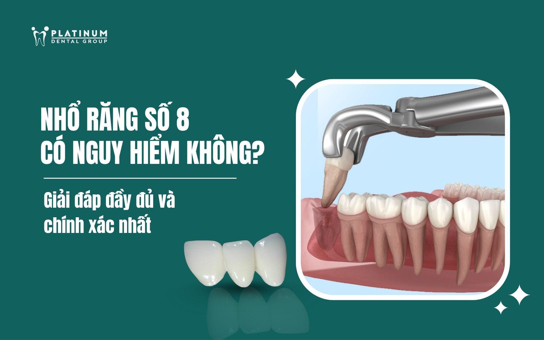 nhổ răng số 8 có nguy hiểm không