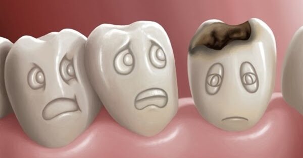 Hướng dẫn cách xử lý xiết ăn răng ở trẻ 25 Xiết ăn răng sẽ khiến trẻ đau nhức vô cùng khó chịu