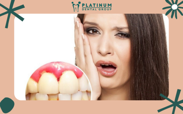 Bệnh chảy máu chân răng và những kiến thức cần biết 25 Những biến chứng nguy hiểm của bệnh chảy máu chân răng