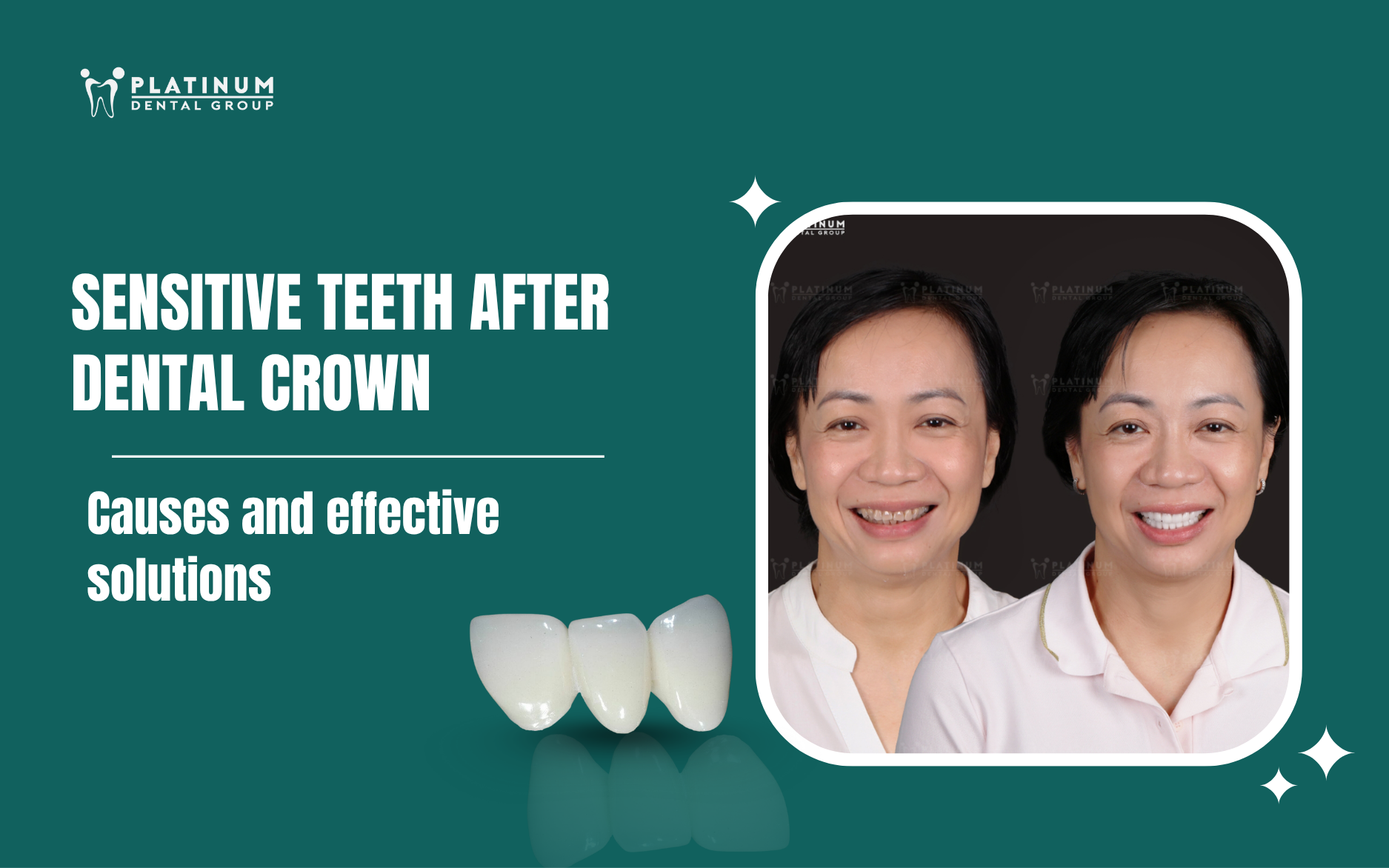 tooth sensitivity after crown