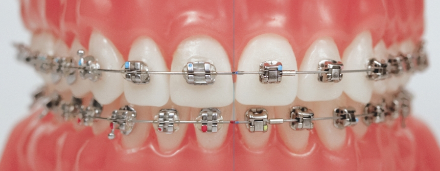 nieng-rang-khap-khenh-co-kho-khong-mat-thoi-gian-bao-lau-5