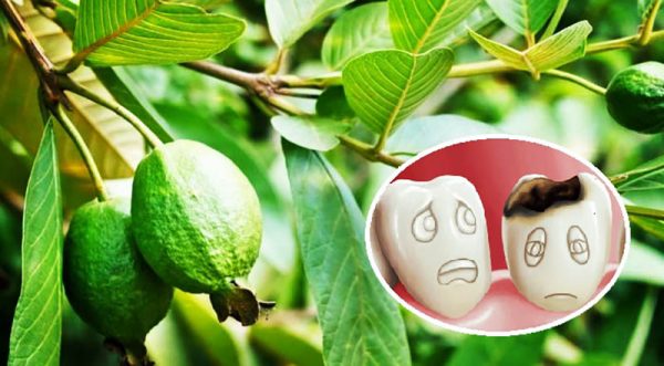 Lá gì chữa sâu răng hiệu quả, an toàn và mau khỏi nhất 25 Lá ổi non giã nát kèm với muối chính là “ khắc tinh” của chứng bệnh sâu răng)
