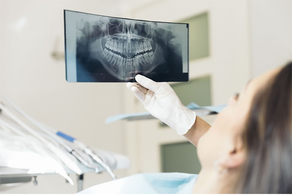 Các yếu tố nào ảnh hưởng đến chi phí niềng răng trong suốt Invisalign?