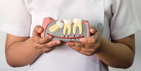 Khi niềng răng Invisalign có cần nhổ răng hay không ?