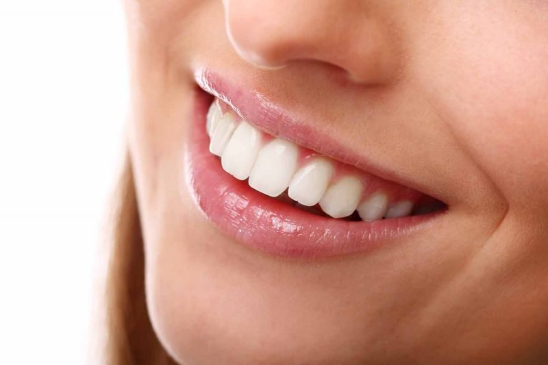 Liên hệ ngay trung tâm nha khoa uy tín để được hỗ trợ khắc phục sự cố sứ Veneer mẻ hiệu quả Liên hệ ngay trung tâm nha khoa uy tín để được hỗ trợ khắc phục sự cố sứ Veneer mẻ hiệu quả
