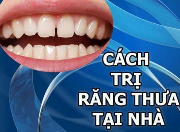 Cách điều trị răng thưa tại nhà đơn giản mà hiệu quả 20 Điều trị răng thưa tại nhà như thế nào để đạt hiệu quả