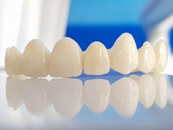 Nên niềng răng hay bọc sứ? Phương pháp nào tốt hơn? 2 Ưu - nhược điểm của phương pháp bọc răng sứ