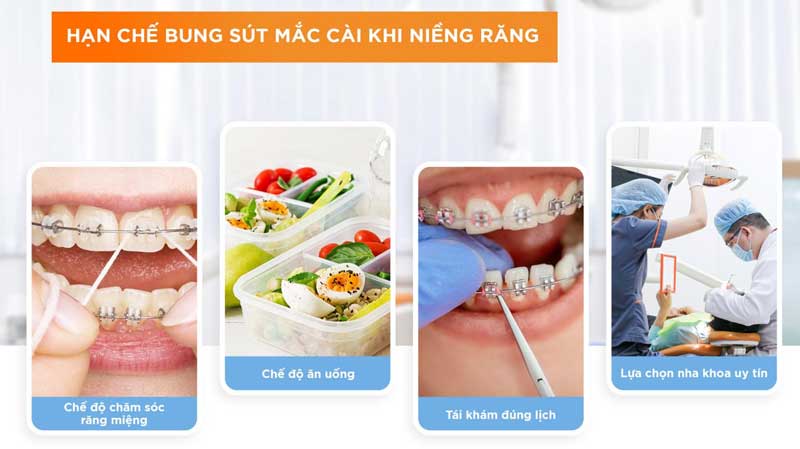 Bạn có thể liên hệ nha khoa trước để xác nhận mình có nuốt niềng răng không?