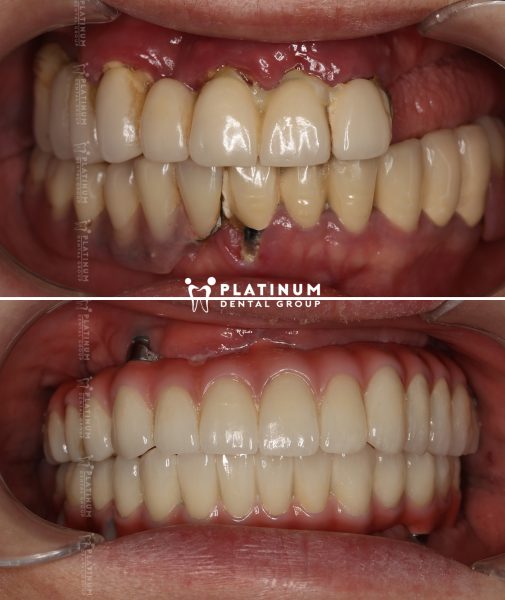 Allon6 3 Lệ DUng 2