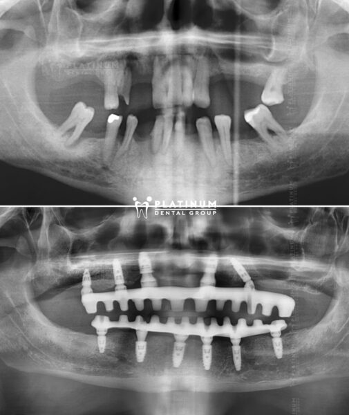 Mr Andrew "Lẽ ra tôi nên đến Platinum sớm hơn" 10 X Andrew
