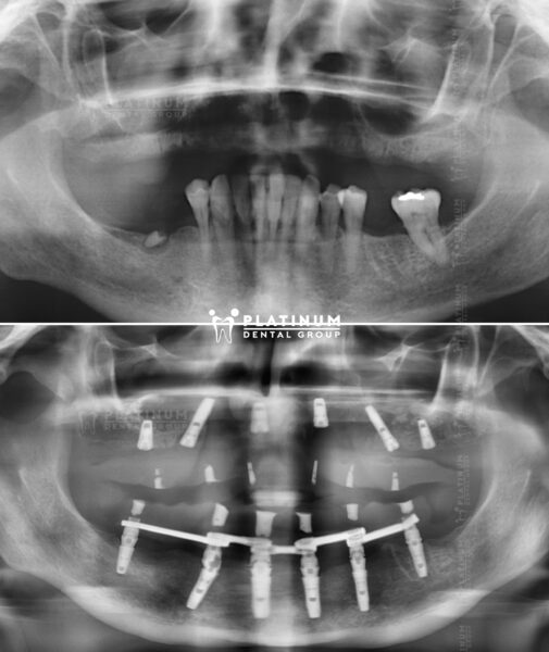 Nụ cười tươi tràn đầy tự tin của cô Annett đến từ Úc 8 X Annett