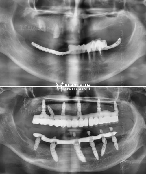 X Nguyễn Thị Lệ Dung