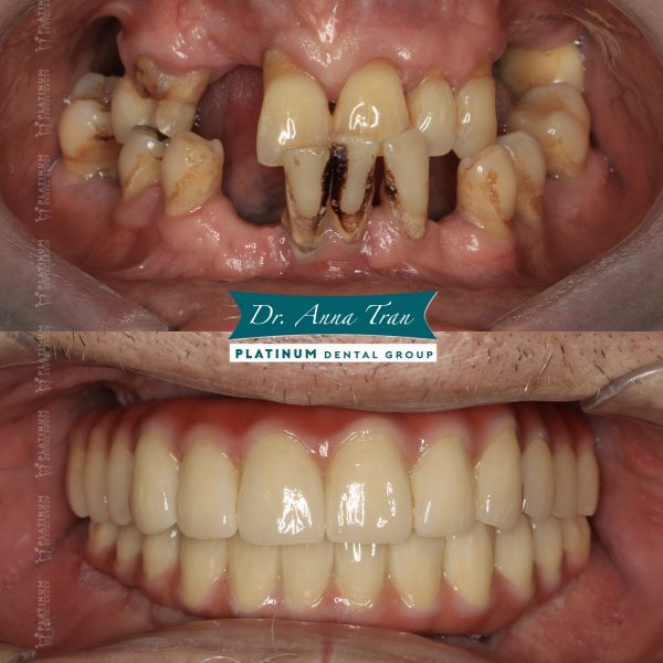 Mr Andrew "Lẽ ra tôi nên đến Platinum sớm hơn" 6 allon4 6 MrAndew 1