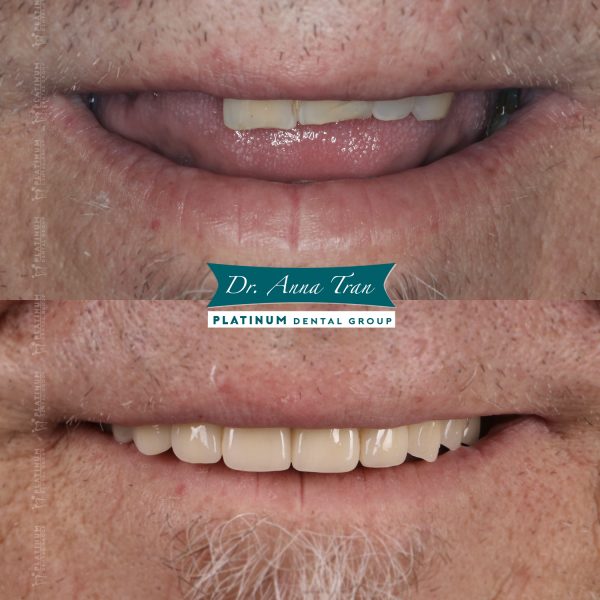 Mr Andrew "Lẽ ra tôi nên đến Platinum sớm hơn" 9 allon4 6 MrAndew 4