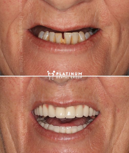 Nụ cười tươi tràn đầy tự tin của cô Annett đến từ Úc 7 allon4 7 Annett 4