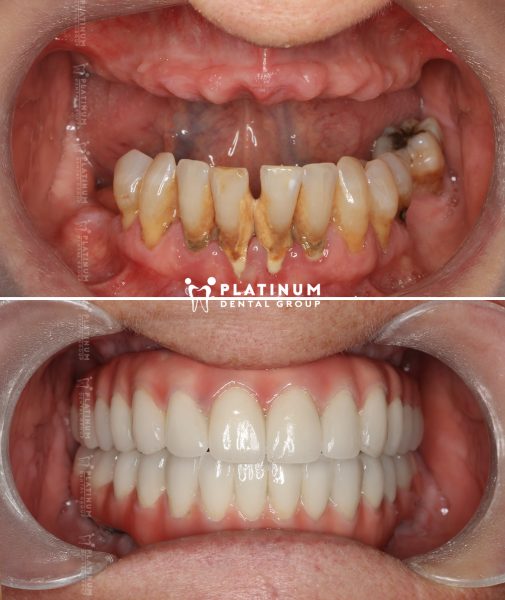 Nụ cười tươi tràn đầy tự tin của cô Annett đến từ Úc 9 allon4 7 Annett 5