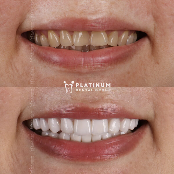 Nụ cười thu hút sẽ để lại ấn tượng sâu sắc 5 nucuoithuhut1