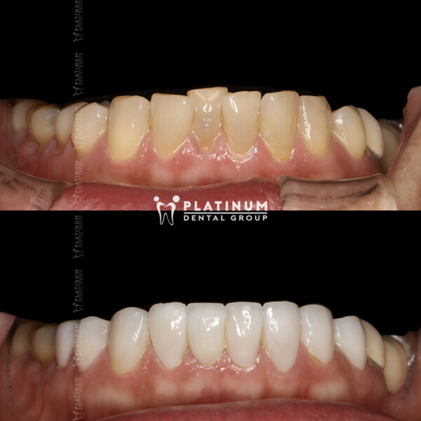 Nụ cười thu hút sẽ để lại ấn tượng sâu sắc 7 nucuoithuhut3