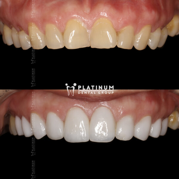 Nụ cười thu hút sẽ để lại ấn tượng sâu sắc 8 nucuoithuhut4