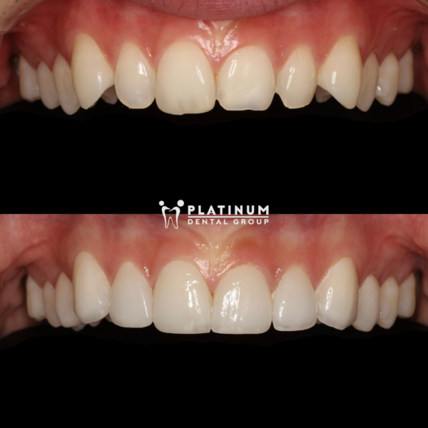 RĂNG CHƯA ĐẸP CHỈ LÀ CHƯA ĐƯỢC ĐẾN PLATINUM THÔI 8 294874365 3233802930193746 4741587858742537114 n