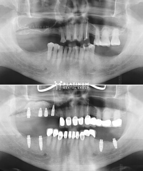 Nụ cười tươi trẻ của Mr. Dean Salonga 4 X Dean Salonga