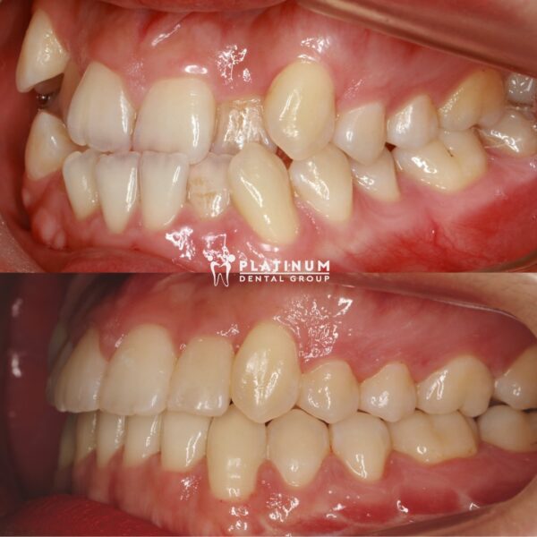 Hương Ly đã lấy lại được nét đẹp rạng rỡ của mình 7 huongly2