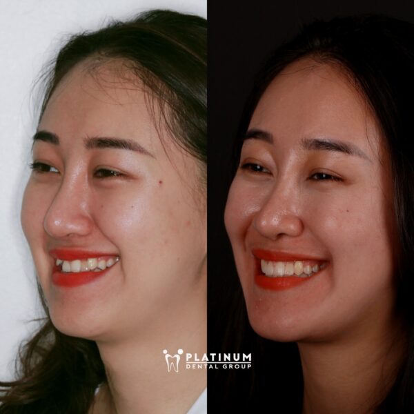 Hương Ly đã lấy lại được nét đẹp rạng rỡ của mình 10 huongly4