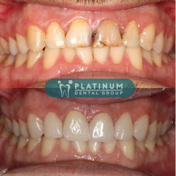 24 NĂM TÌM LẠI SỰ TỰ TIN 8 284063064 3191500064424033 679111410220636106 n