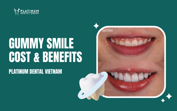 Gummy Smile Treatment