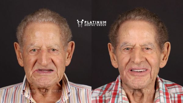 Platinum Dental Group provides expert care to ensure lasting results and a beautiful, functional smile