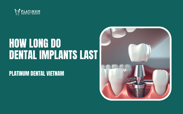 how long do dental implants last