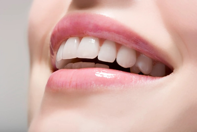 Is teeth whitening safe?