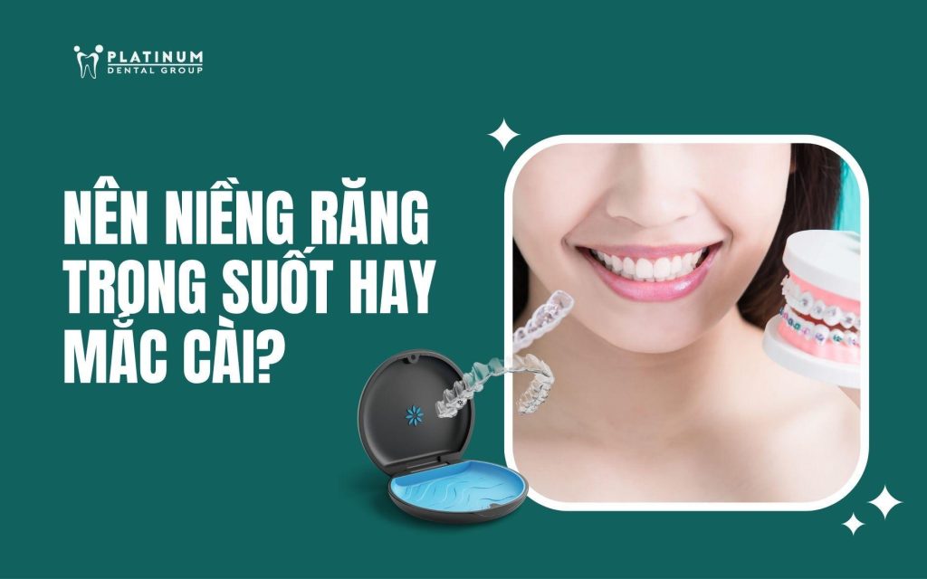 nên niềng răng trong suốt hay mắc cài
