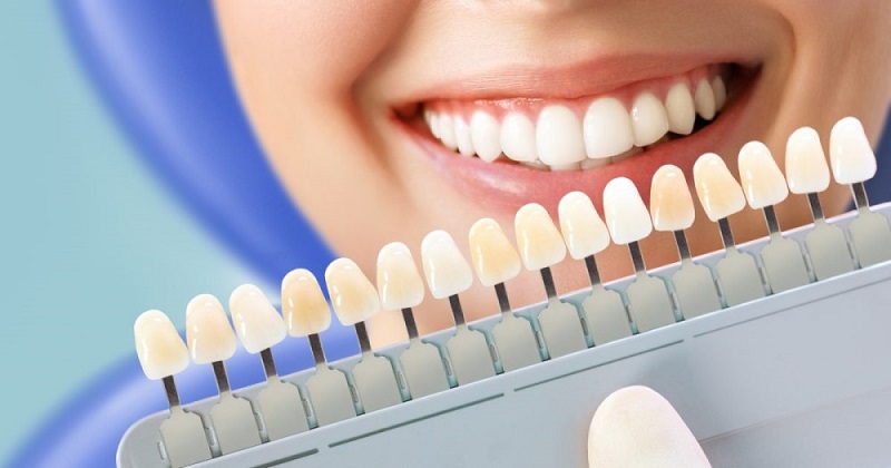 Teeth Whitening Ingredients - What Makes Your Pearly Whites Glow?