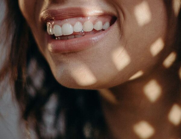 Chữa răng hô không cần niềng