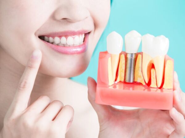 Địa chỉ trồng răng Implant uy tín tại TP.HCM - Bí quyết chọn nha khoa chất lượng và an toàn 1 Lựa chọn đúng địa chỉ trồng Implant giúp bạn yên tâm về sức khỏe, thẩm mỹ và sự an toàn lâu dài