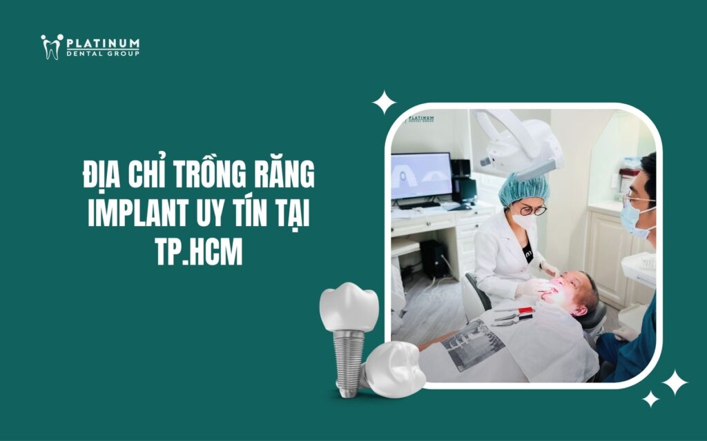địa chỉ trồng răng Implant uy tín