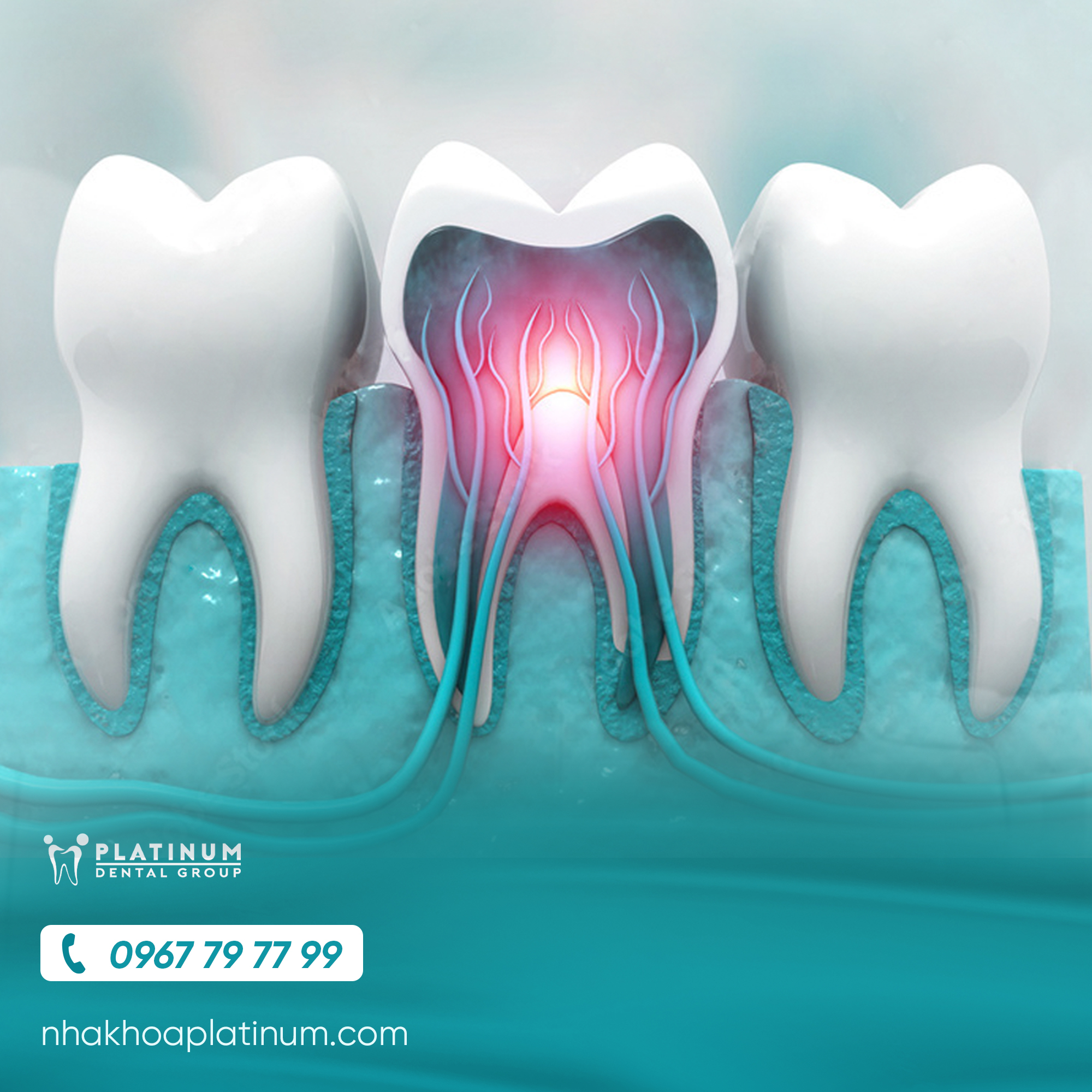 Dịch vụ 3 dieu tri tuy