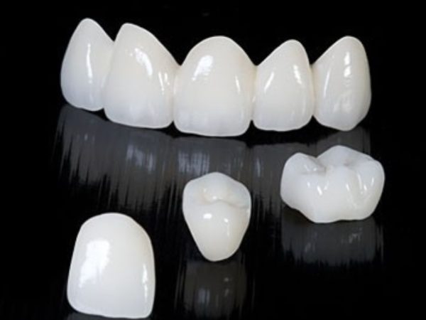 Bọc răng sứ có tốt không? Đánh giá từ A đến Z 5 Răng toàn sứ được chế tạo hoàn toàn từ sứ cao cấp như E.max, Cercon hay Lava
