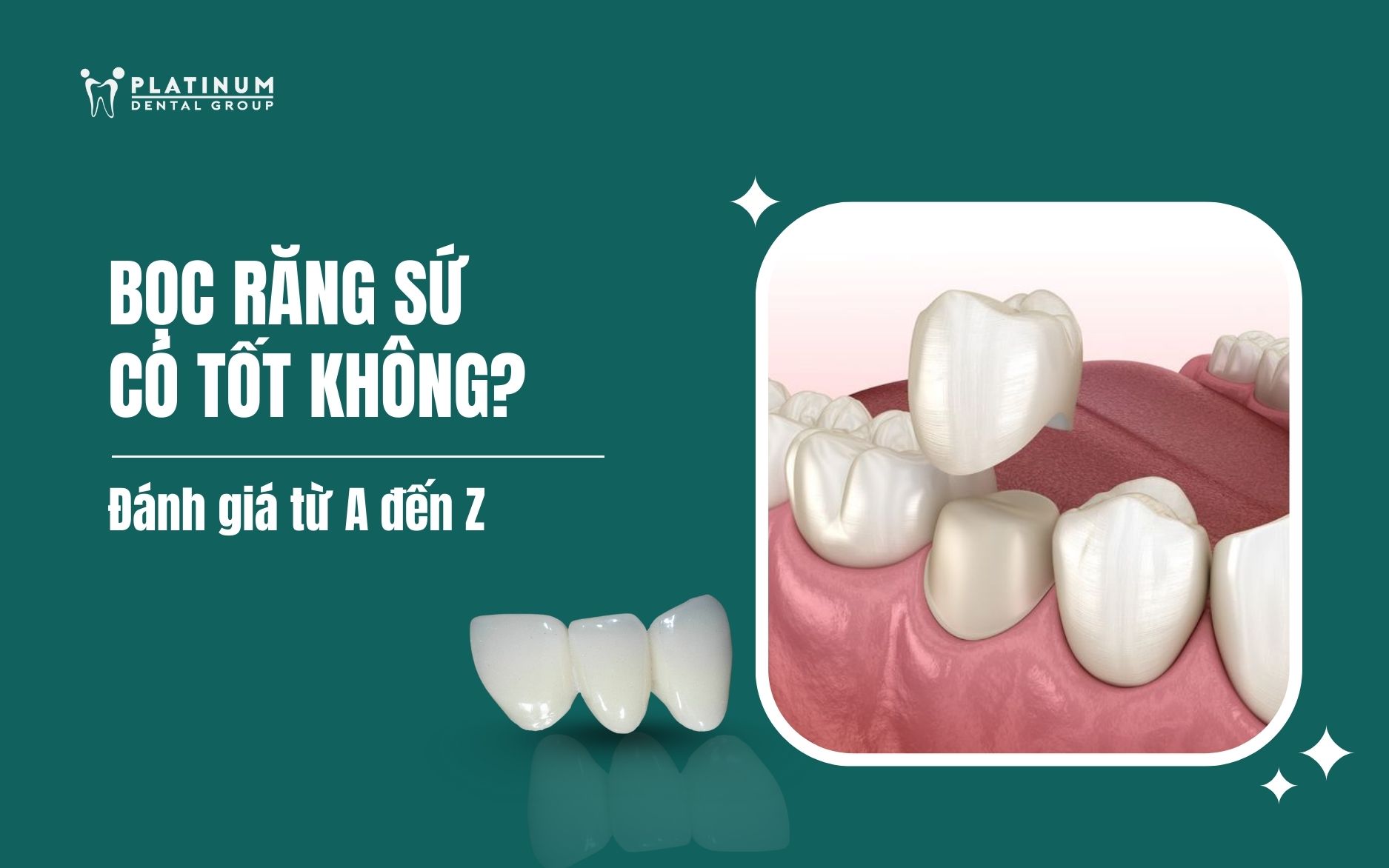 bọc răng sứ có tốt không