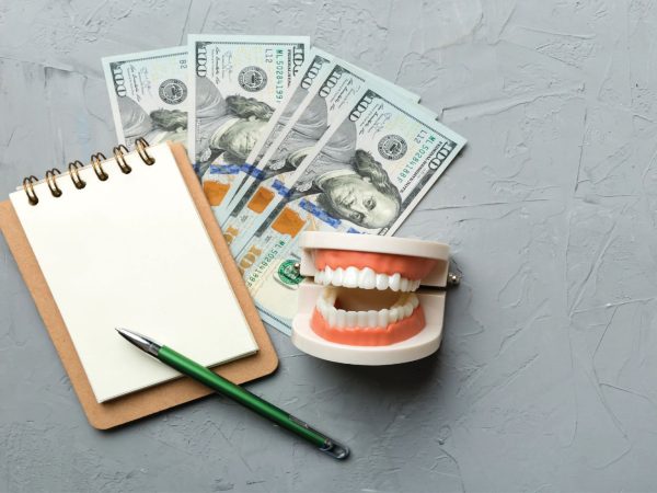 Chi phí dán sứ cao hơn khá nhiều so với các phương pháp khác