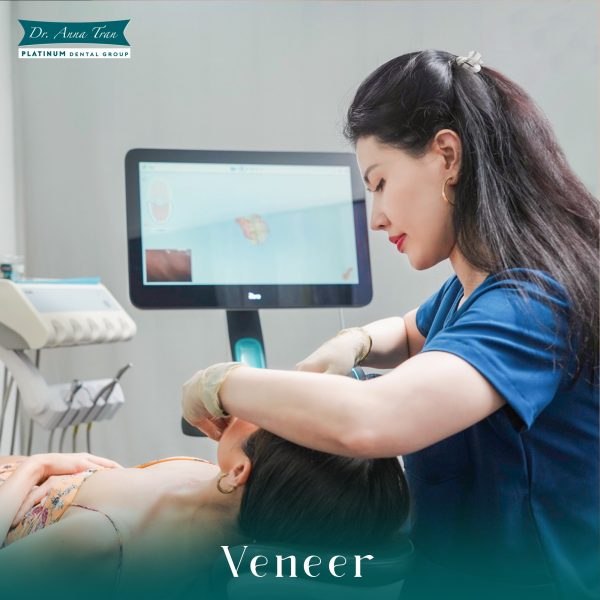 Tìm hiểu về ưu - nhược điểm của dán răng sứ 9 Kiểm tra định kỳ 6 tháng/lần để bác sĩ đánh giá tình trạng veneer