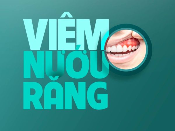 Bọc răng sứ có bị hôi miệng không? Câu trả lời từ chuyên gia 5 Bạn cần điều trị triệt để các bệnh lý răng miệng như viêm nướu, viêm nha chu trước khi bọc lại răng sứ