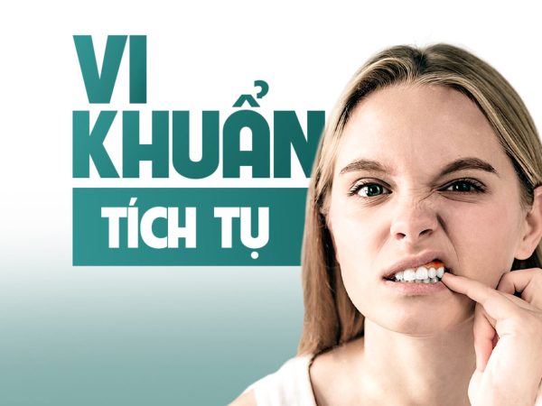 Bọc răng sứ có bị hôi miệng không? Câu trả lời từ chuyên gia 2 Sai kỹ thuật hoặc khe hở giữa răng sứ và nướu