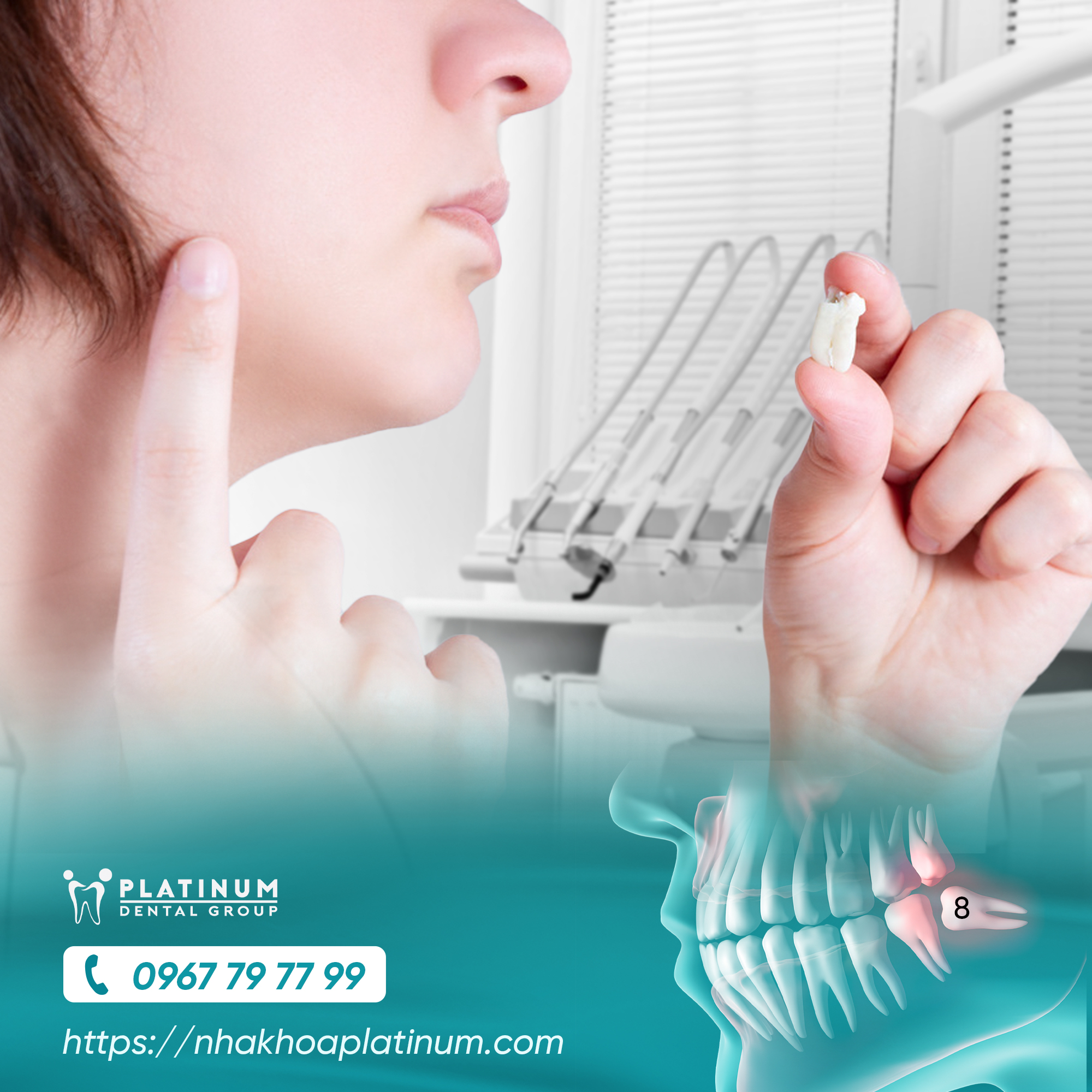 Dịch vụ 6 DV RANG KHON 1