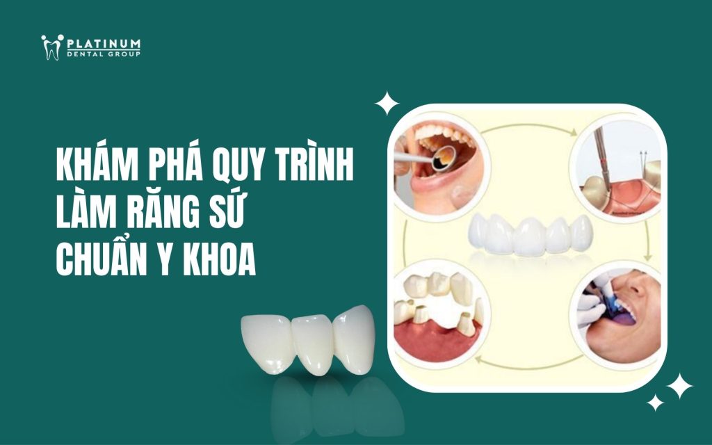 quy trình làm răng sứ