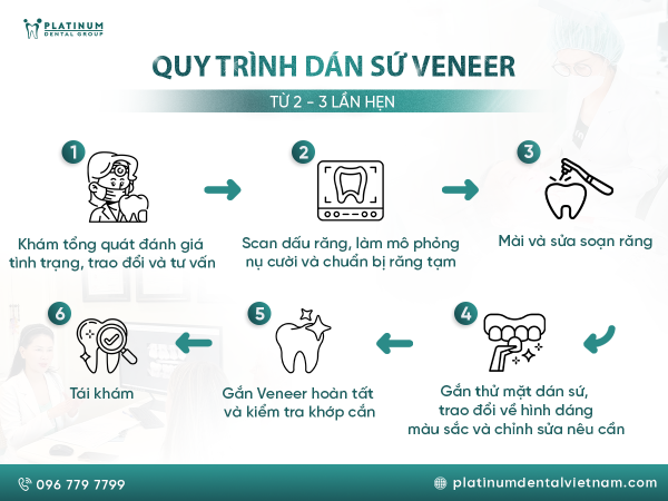 Quy trình Veneer tại Platinum Dental Group