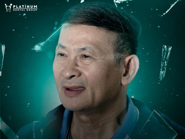 Người bị tiêu xương hàm nghiêm trọng nên làm cầu răng sứ