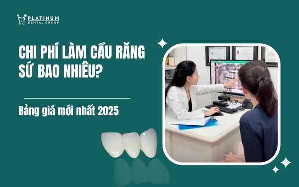 chi phí làm cầu răng sứ