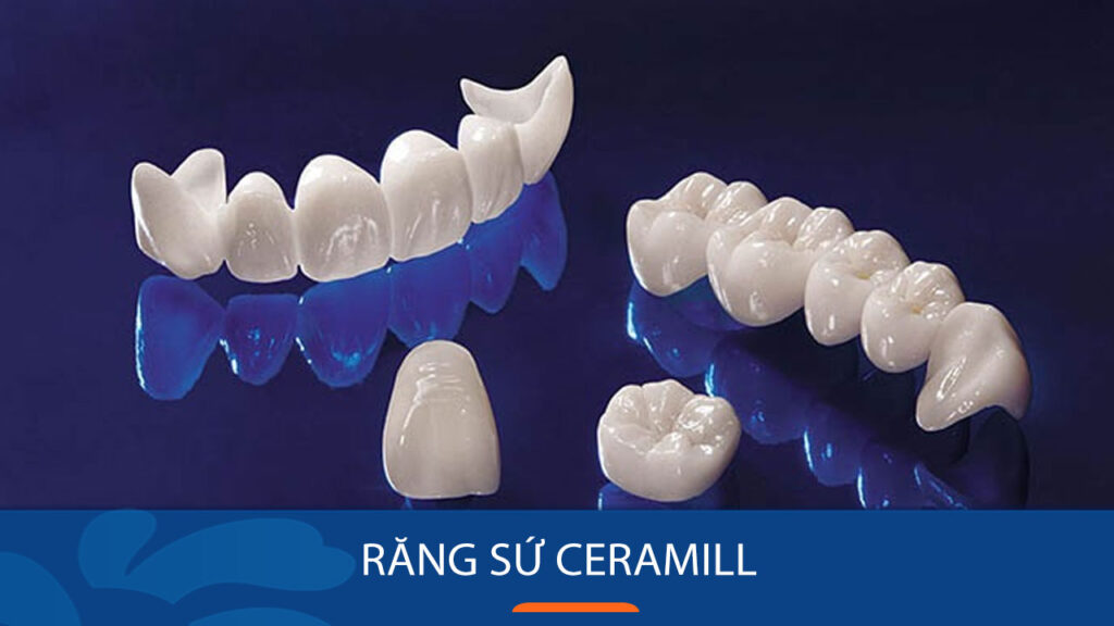 Răng Sứ Ceramill Là Gì? Của Nước Nào? Giá Bao Nhiêu? 1 Răng toàn sứ Ceramill có 2 loại chính
